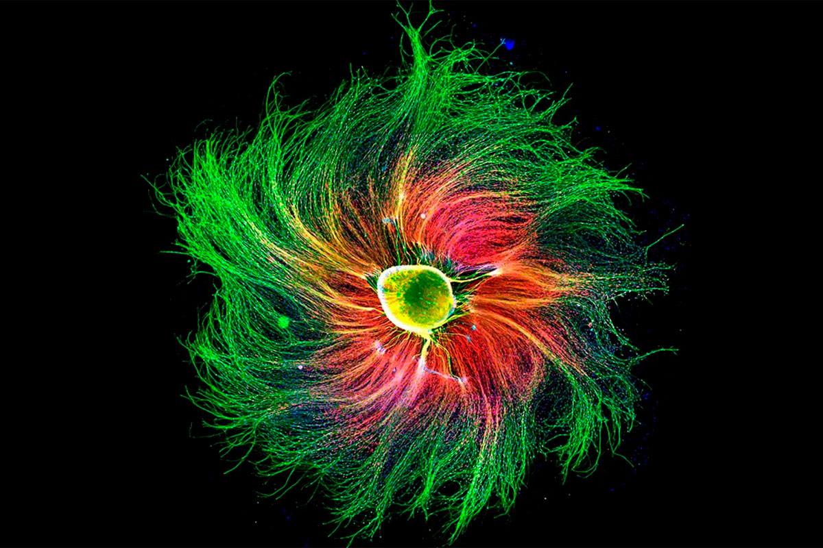 CÃ©lulas nerviosas de un embriÃ³n de rata. (FOTO: Paula DÃaz).